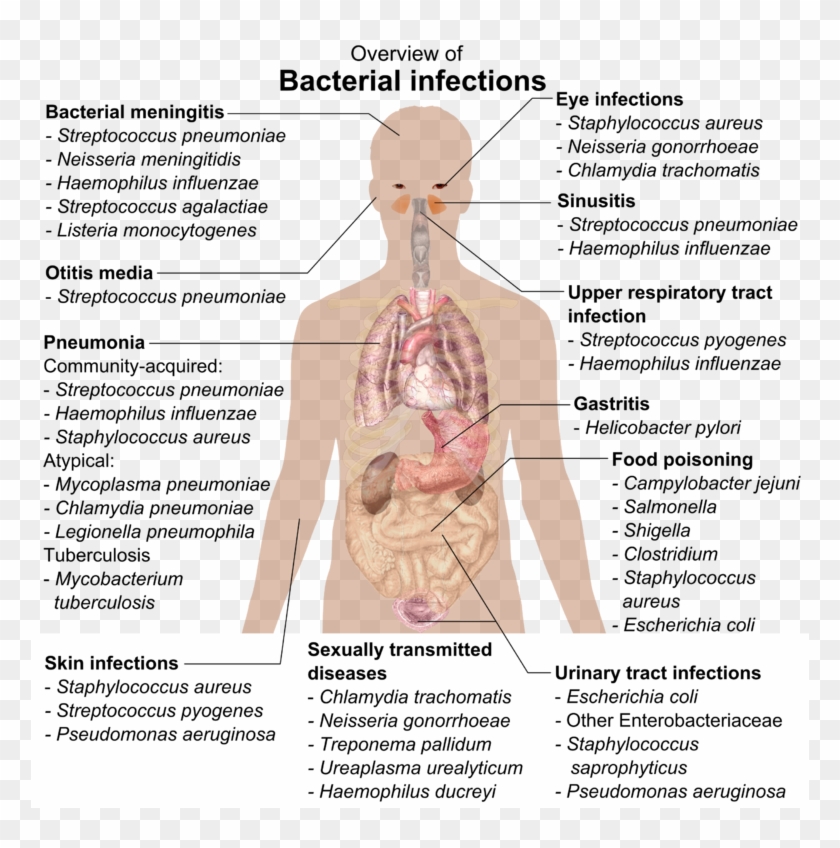 Bacterial Infections And Involved Species - Overview Of Bacterial Infections Clipart