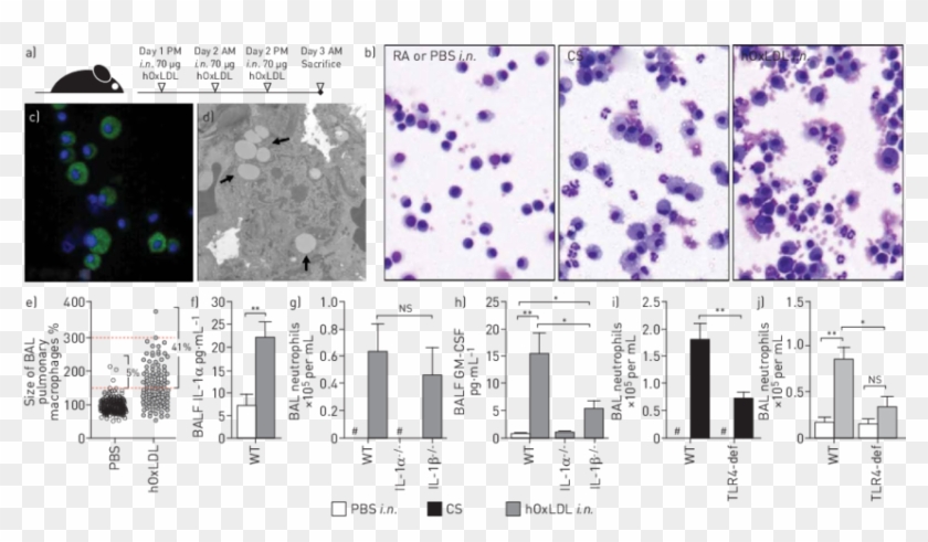 Pulmonary Exposure To Damaged Transparent Background - Foam Cells Cytospin Clipart #960040