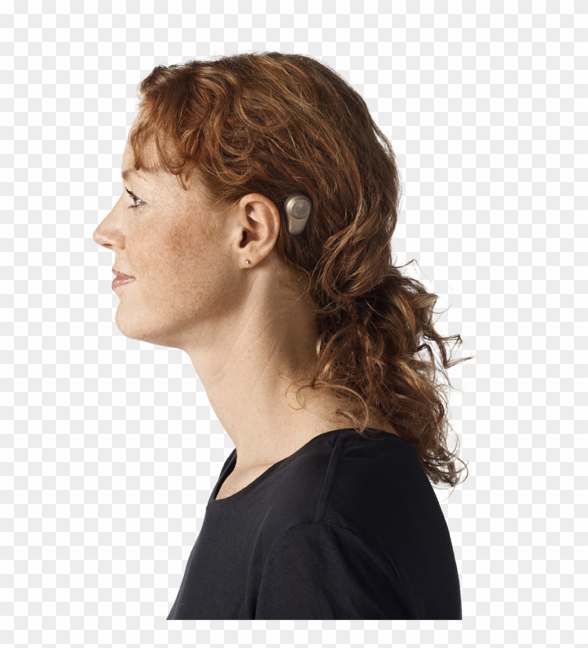 The Sound Processor From Oticon Medical Behind The - Bone Anchored Hearing Aid Nz Clipart