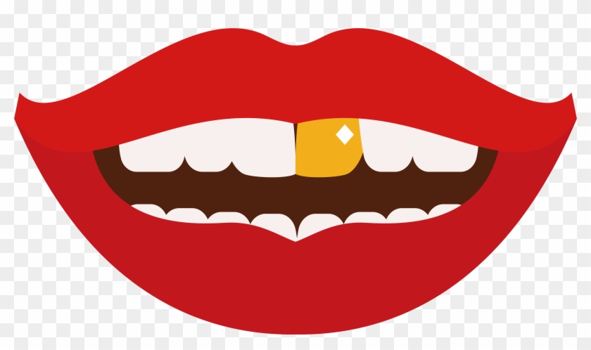 4826 X 2636 12 - Gold Tooth Clipart Transparent - Png Download #984343