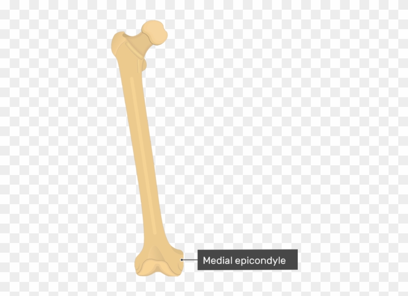Medial Epicondyle - Femur Bone - Anterior View - Patellar Surface Of Femur Clipart #998247